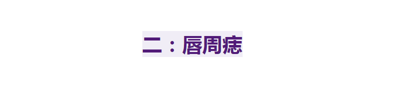 别再乱动脸上的痣了，如果你脸上这4个部位有痣，到老都优雅