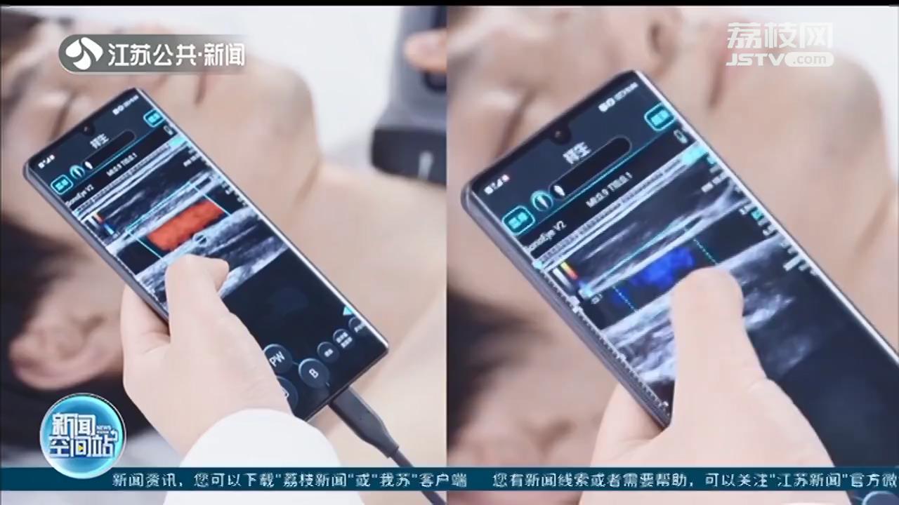 无锡研发伤病扫查超声设备、滑雪跳台电梯苏州造&hellip;江苏力量助力冬奥