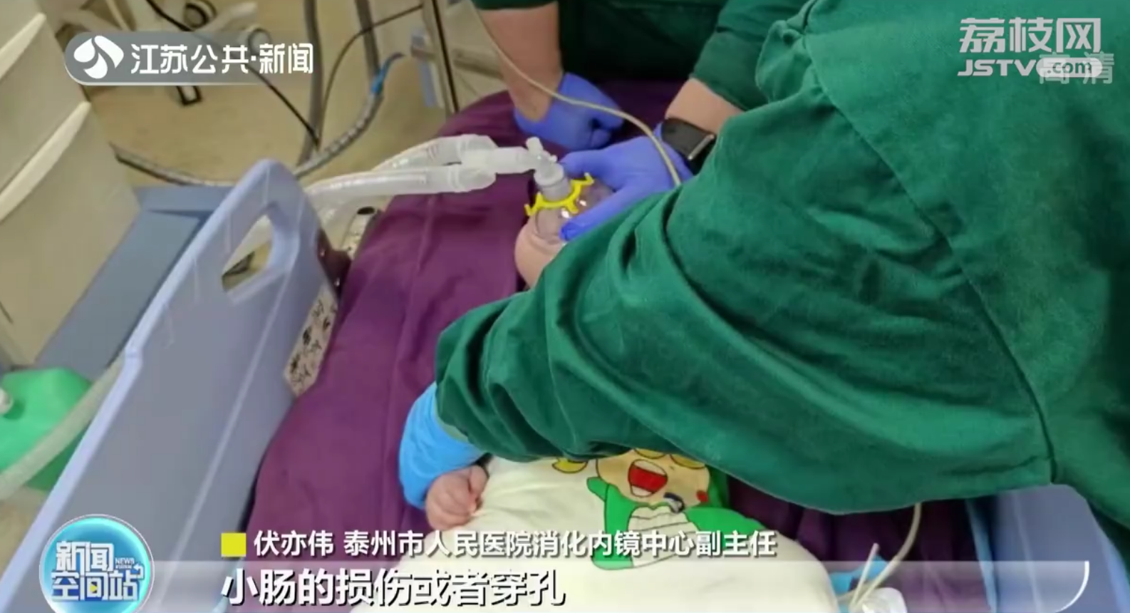 泰州4个月宝宝扯下奶奶耳坠吞下肚 医生胃镜手术取出