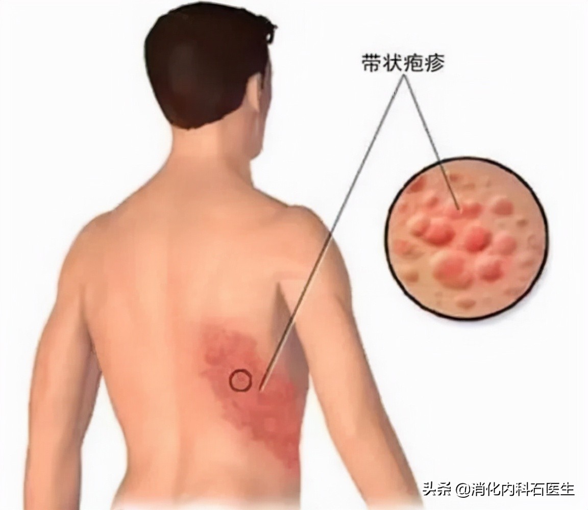 男子腹痛难忍病因难寻，这时肚子上露出一条红线，医生：快会诊