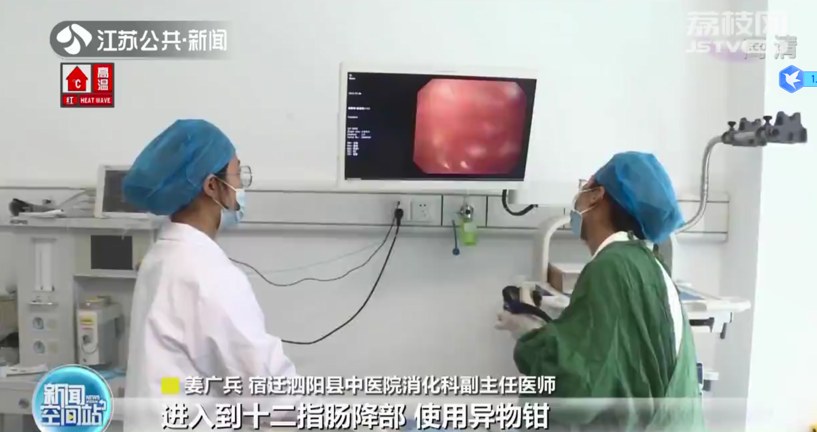 宿迁泗阳：男子喝酒误吞7cm牙签 肚痛3天肠子被刺穿