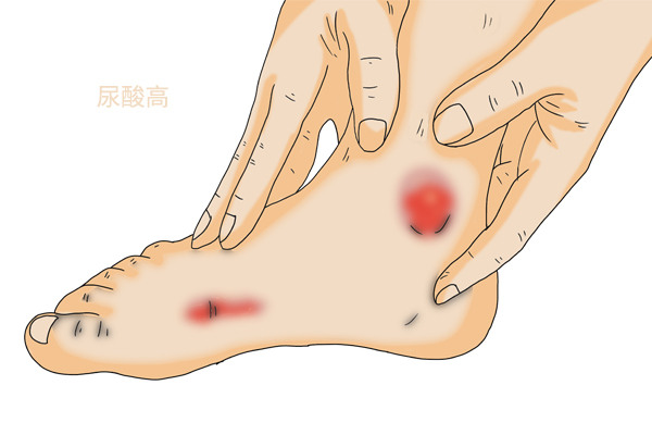 血压、血脂多少算正常？不知道的看过来，三高、尿酸标准数值都有