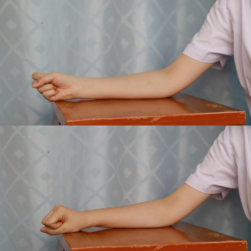 健康科普|“网球肘”不容忽视，这样锻炼远离疼痛！