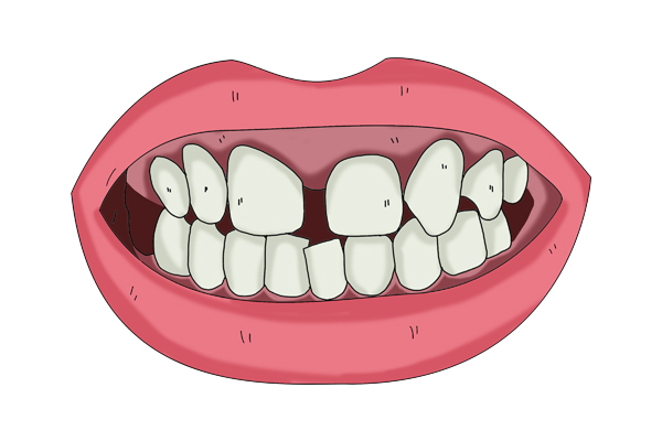 男性变老时，身上会逐渐露出4个丑态，一个不占，值得庆幸