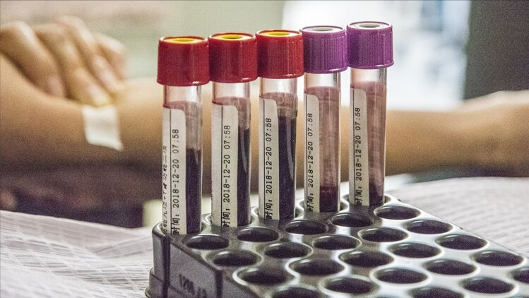 检查凝血功能多少钱(抽血能检查出什么病) - 价格百科