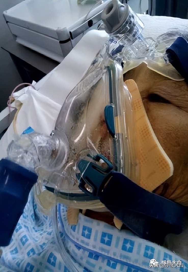 无创呼吸机使用(无创呼吸机使用方法) - 趣味头条