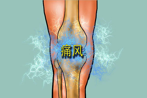 长期吃3种药可能会诱发痛风，如果你正在吃，建议调整方案