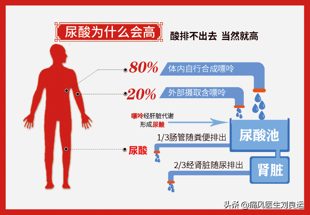 体检发现尿酸高并不是患高尿酸血症