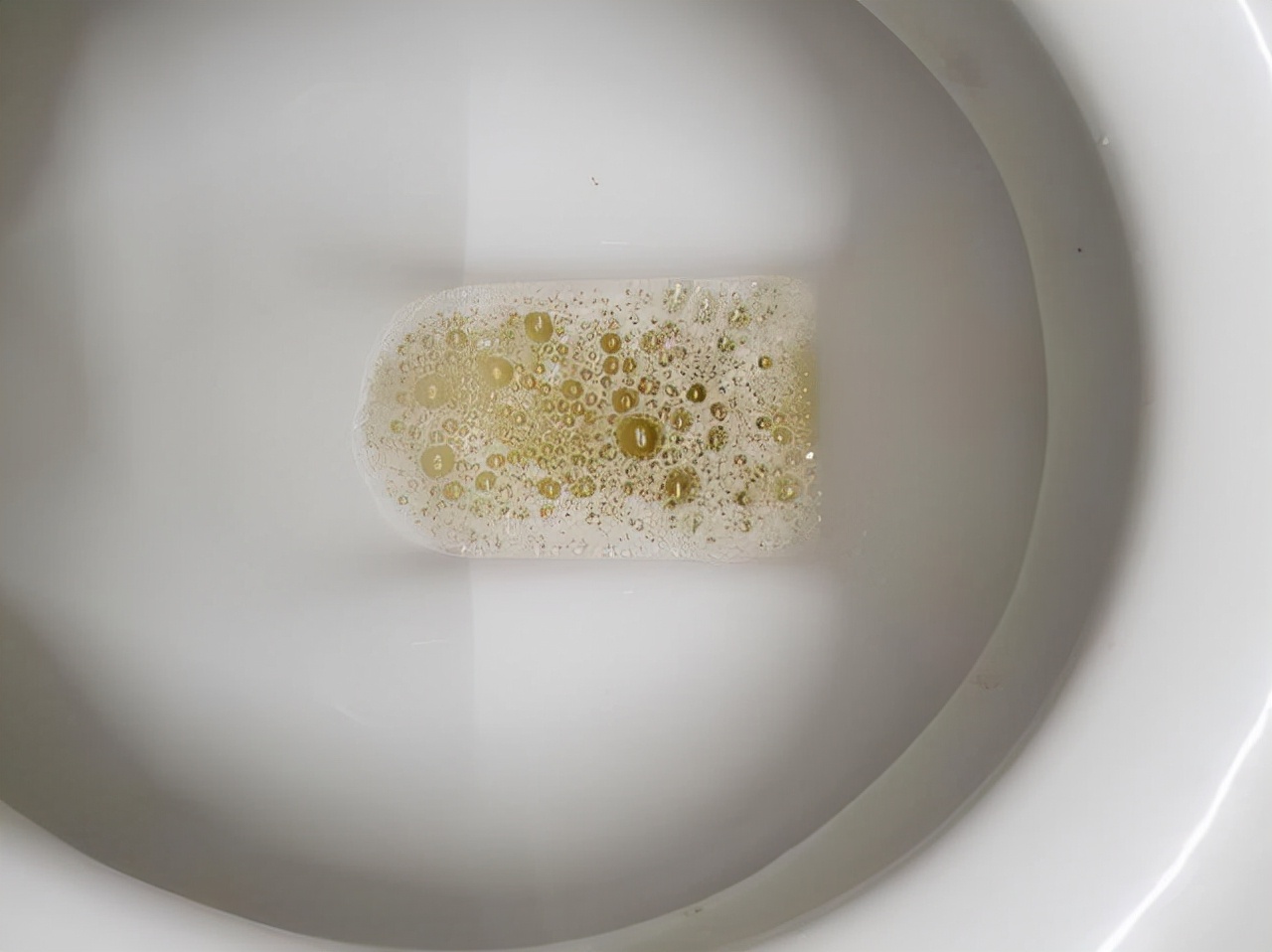 男性晨起“第一次”上厕所，若没有这5个异象，或说明肾脏还不赖