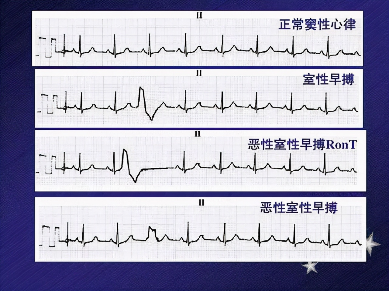 体检查出一身病？已确定：这5种病可以不治，别太放心上