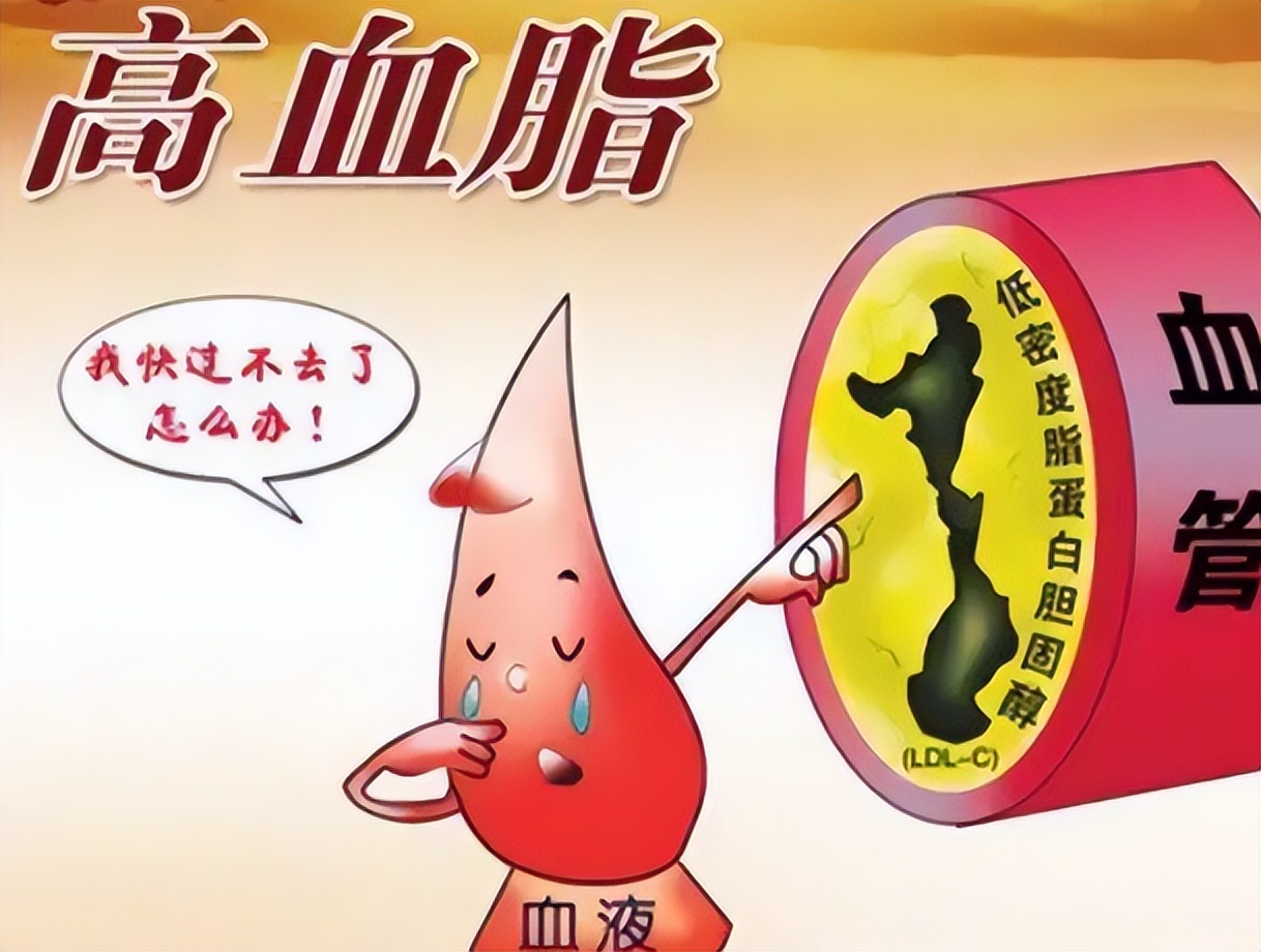 血管外科刁永鹏:什么是血脂高?有哪些危害?快来了解
