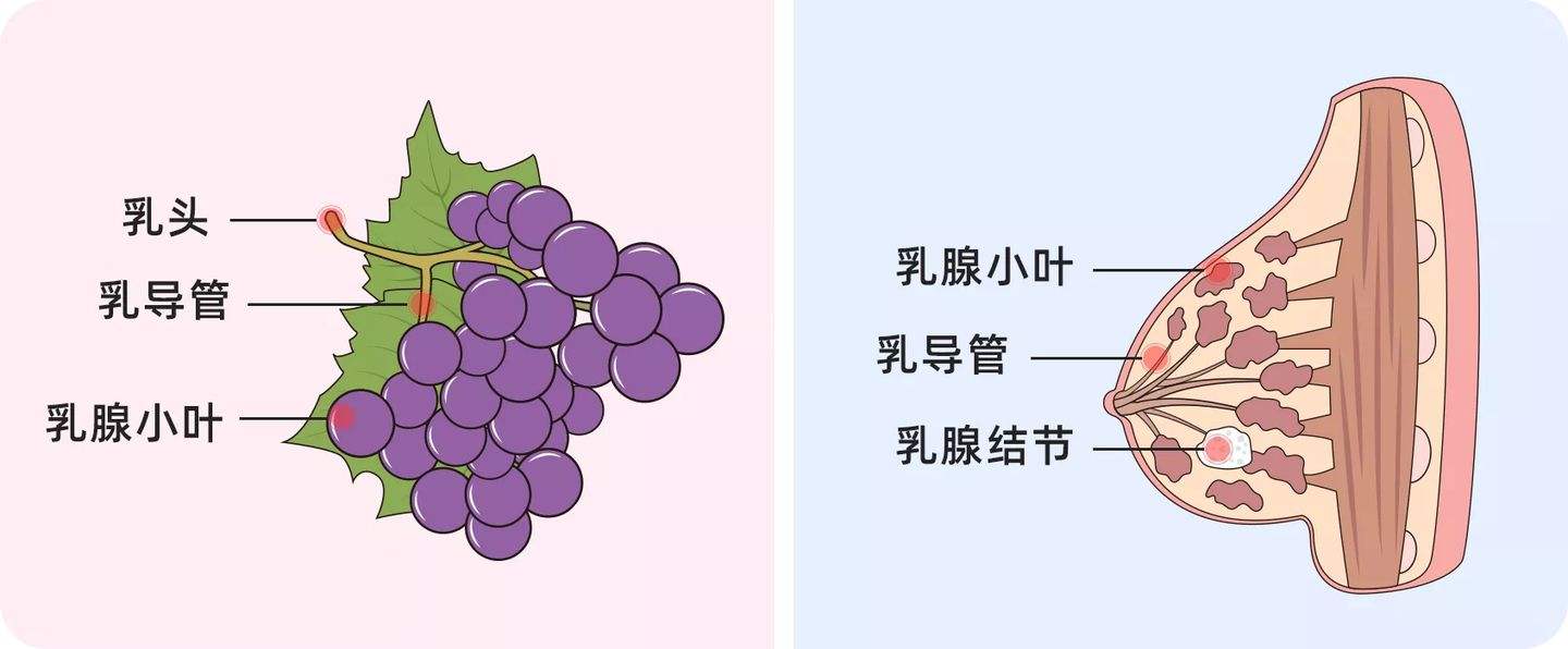 查出乳腺结节3级，坐立难安！大夫直言：小事，消结方法有很多