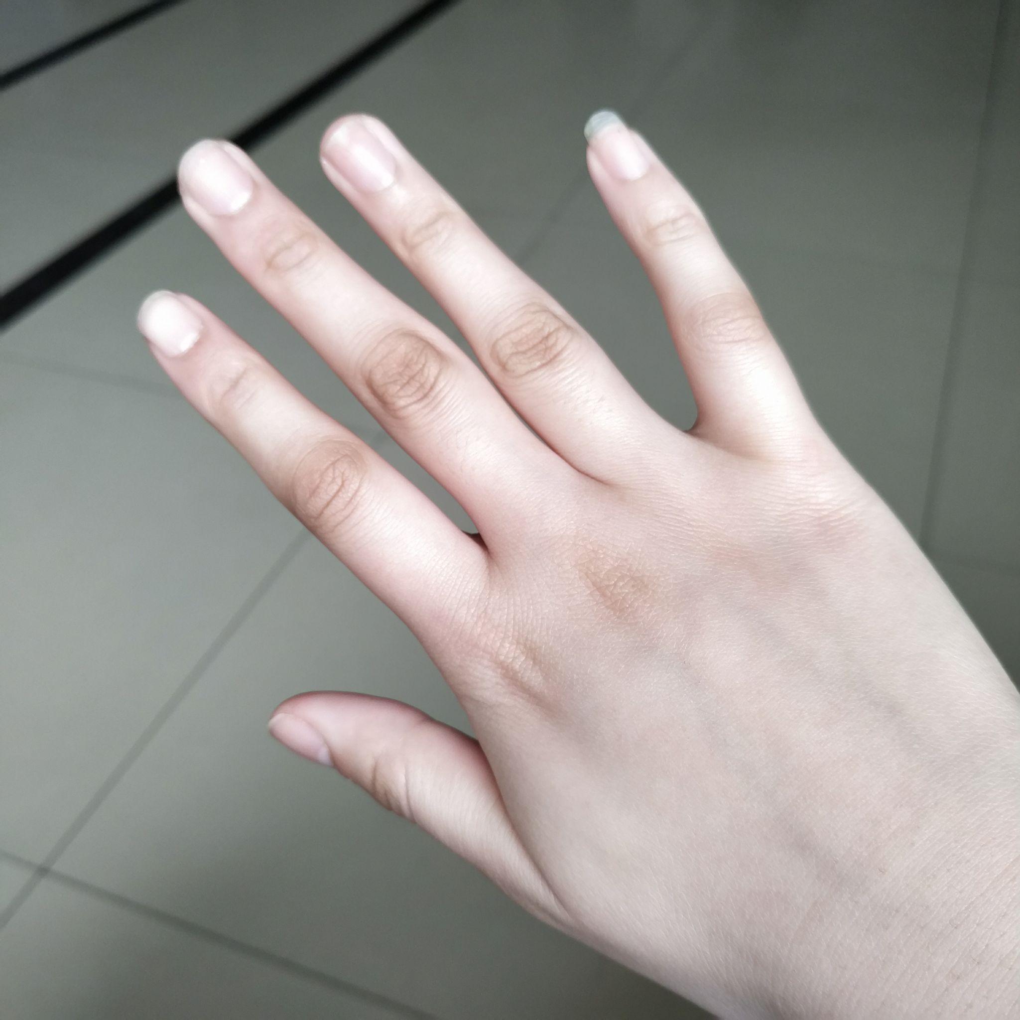 什么疾病会造成指尖发麻呢?这7种因素或就是诱因,尽早就医检查