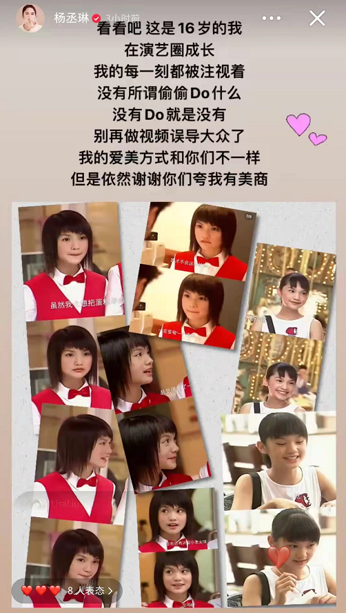 杨丞琳回应整容，喊话不要挑角度误导大众，晒16岁旧照力证天然美