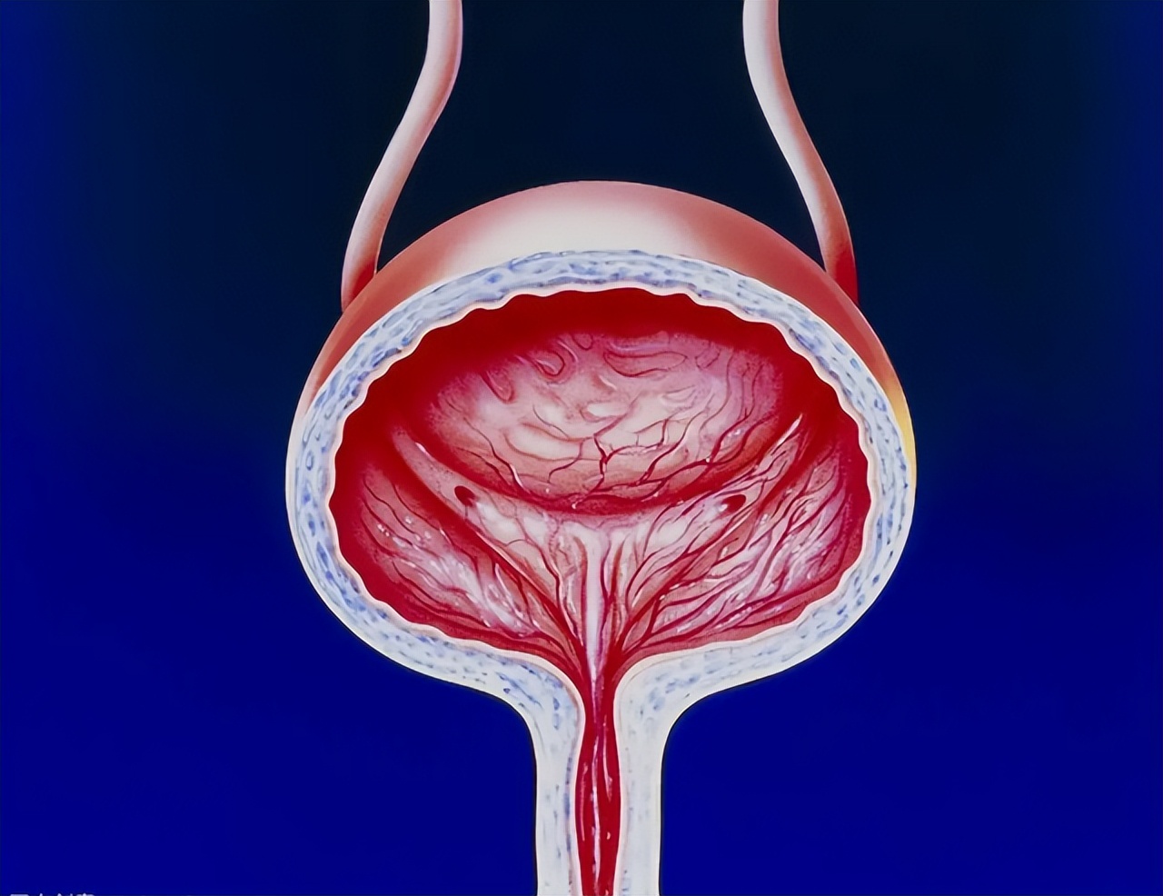 的,也不需要过于担心,而膀胱体积大则需要更多的水分才会导致膀胱充盈