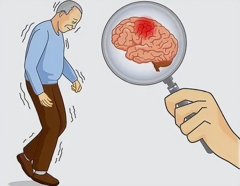 脑中风后遗症患者的饮食禁忌