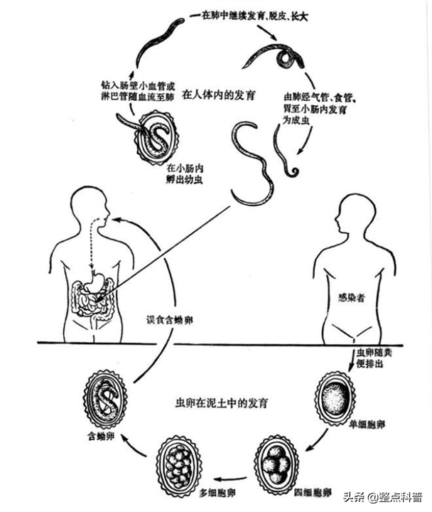 幾十年前 幾乎人人肚子裡都有的蛔蟲 為什麼現在沒有聽說過了 天天看點