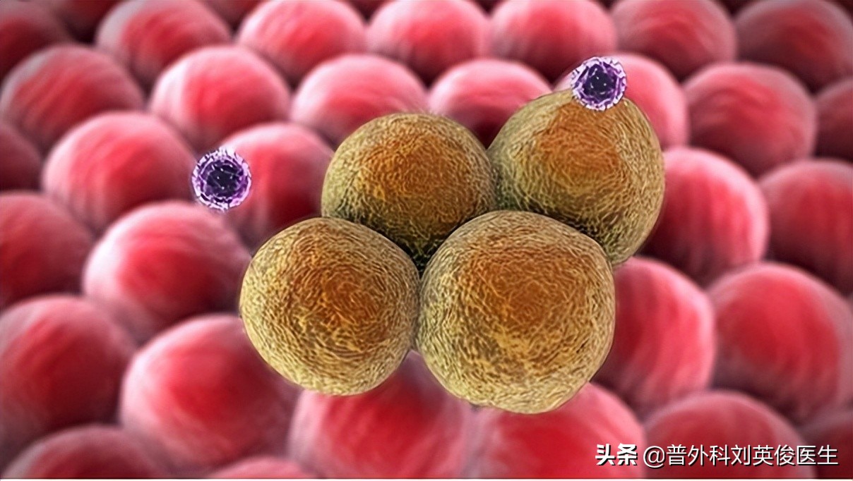 靈芝孢子粉，到底是養生好物還是慢性毒藥？ 癌症患者可以吃嗎？