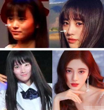 瘦到病态，动脸成瘾，切胃、剪肠齐上阵，内娱的畸形审美真可怕