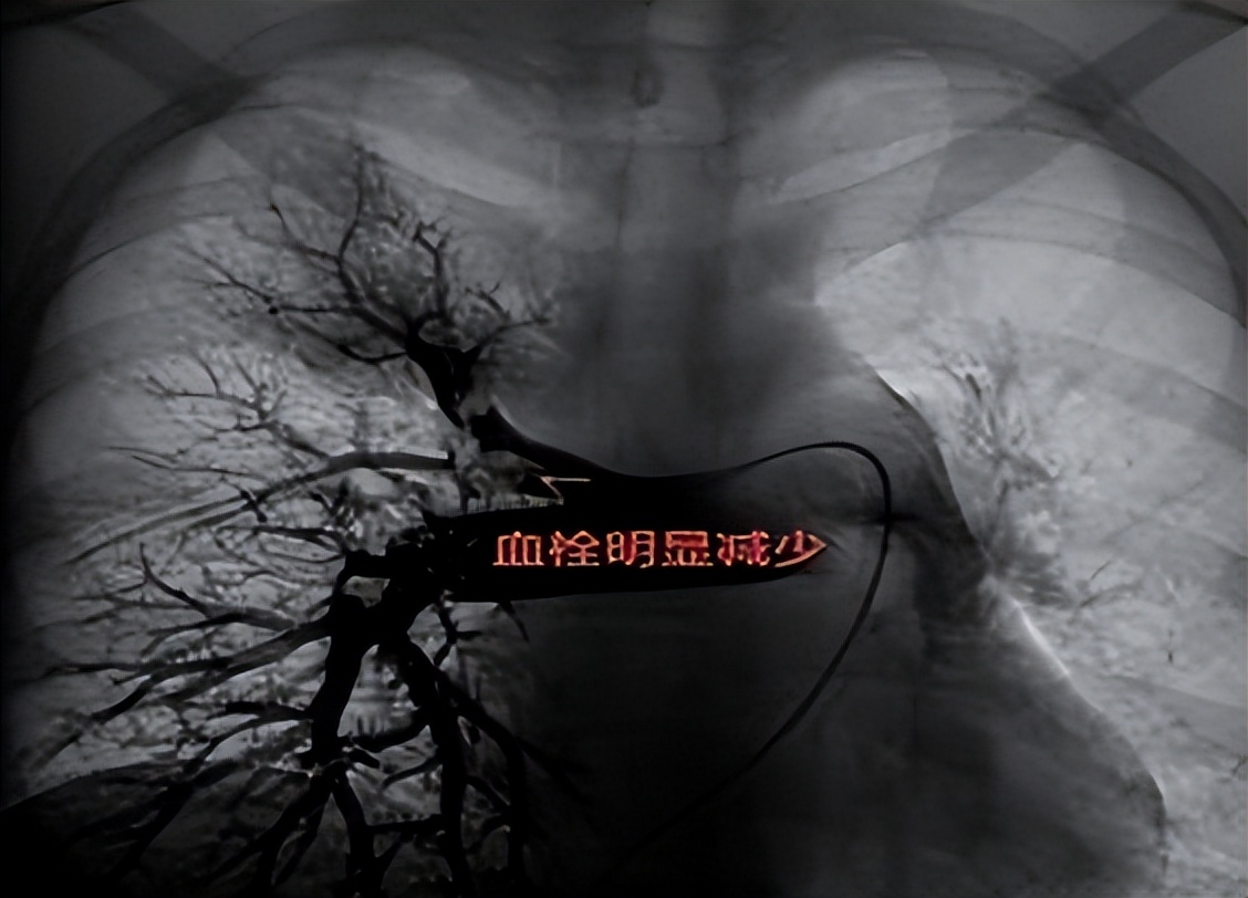 不打烊 更方便 周围血管科（介入科）开设周六全天门诊