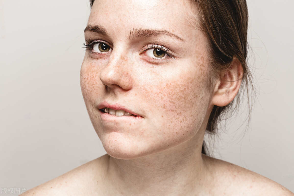 祛斑祛痘怎么做线上推广？