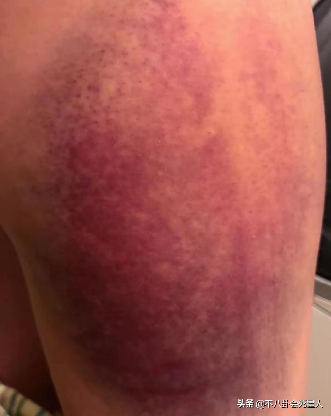 表面恩爱，实际“拳头相向”，从黄奕到黄嘉千，被最亲近的人伤害