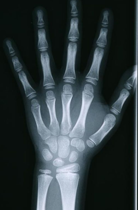 想让孩子多长5厘米,这些情况要注意