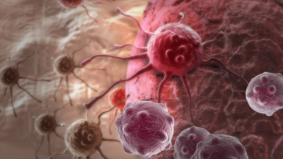 发现早期肝癌，检测甲胎蛋白是关键？肝病医生：这些检查同样重要