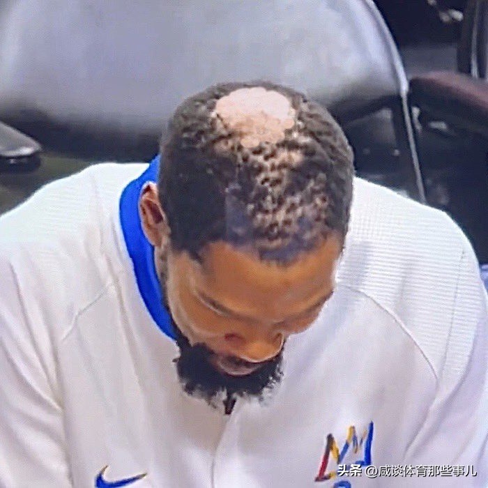 nba光头为什么那么少（有点“秃”然？场均30+7还是第一人，KD头发却掉光！头顶成地中海）