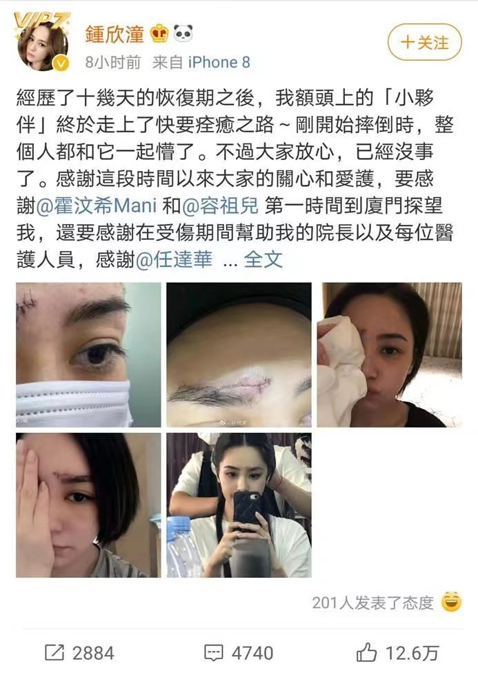 杨幂的眼角，阿娇的脸，明星脸上受伤、毁容，各个让人揪心
