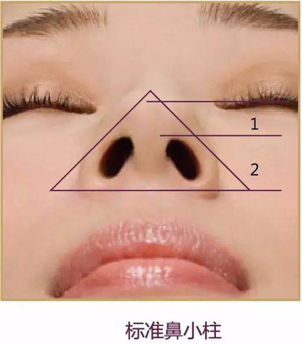 怎么让鼻翼缩小（自测你的鼻翼是否宽大？隆鼻时候一定要缩鼻翼？）