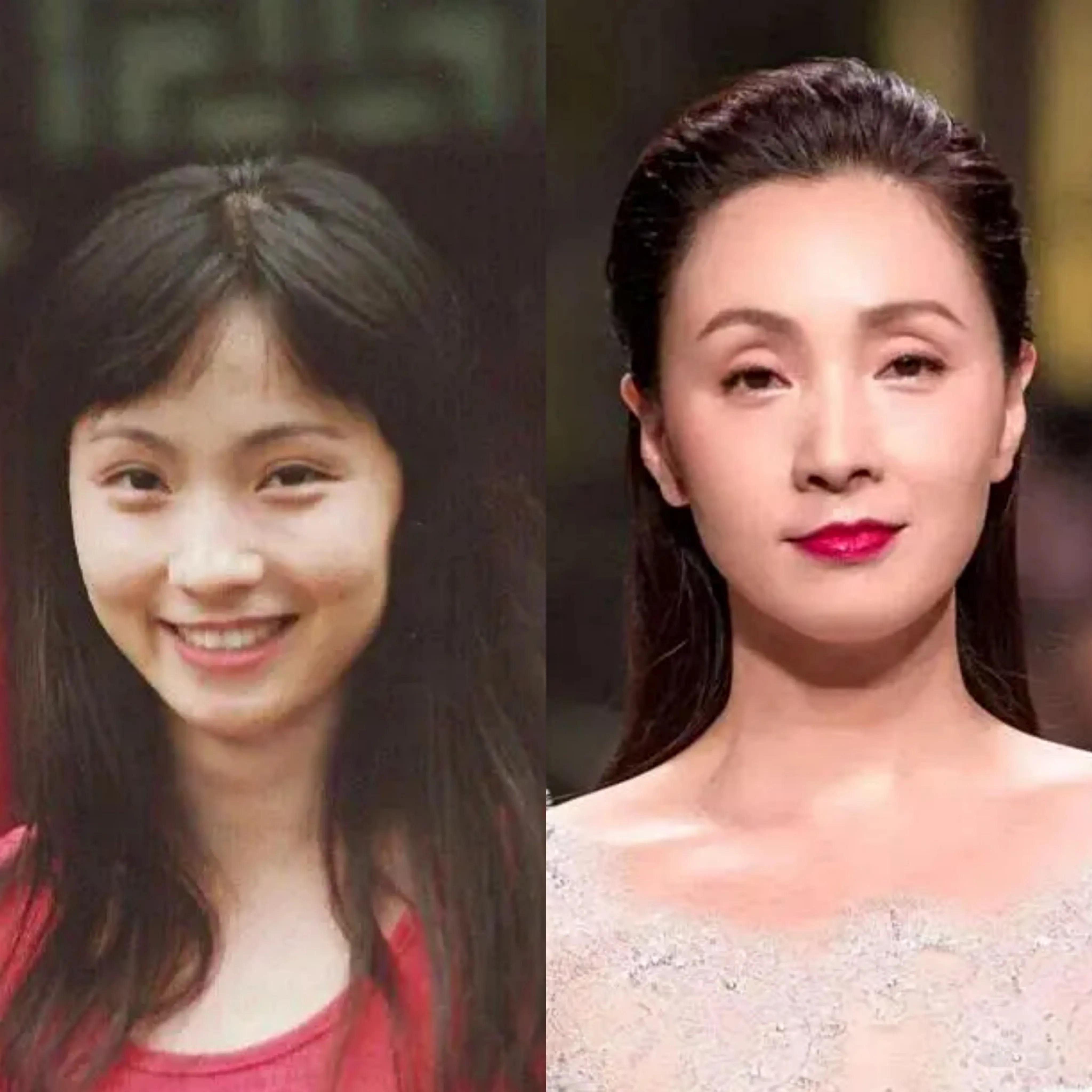 女人眼睛&ldquo;凹陷&rdquo;要注意了