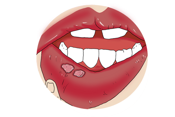 没喝完的瓶装水，放在车内暴晒后不能喝，易增加患癌风险？