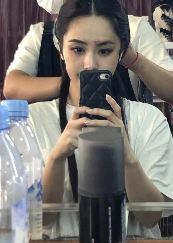 杨幂的眼角，阿娇的脸，明星脸上受伤、毁容，各个让人揪心