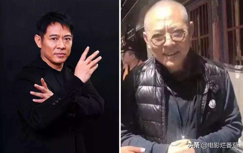 “被顽疾缠身”的7位明星，明明一个比一个有钱，却依旧饱受折磨