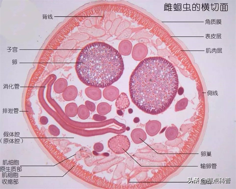 现在怎么没听说了(几十年前，几乎人人肚子里都有的蛔虫，为什么现在没有听说过了？)