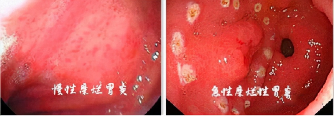 口腔有异味？可能是脾虚湿热！1个方子，健脾胃，祛湿热，除口臭