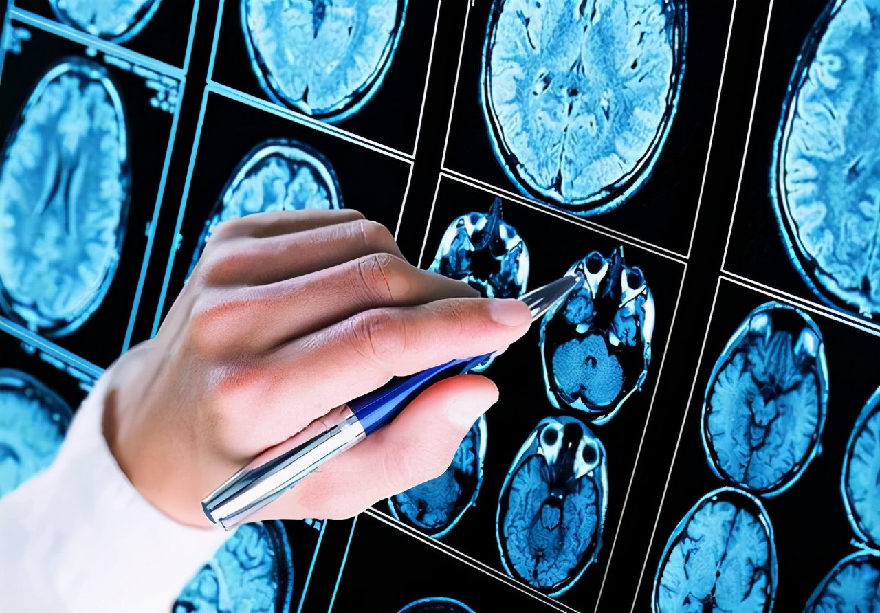 为什么不建议做“脑CT”检查呢？医生揭晓真相，越早知晓越好