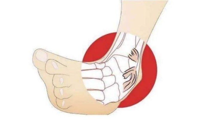 篮球鞋气垫破了能修么（脚踝扭伤：崴脚后应该如何处理？运动员们是如何恢复的？）-华海博客