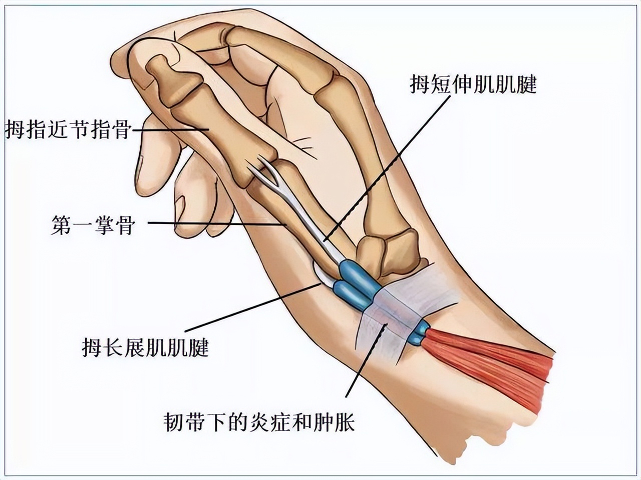 腕部的肌腱高清解剖图图片