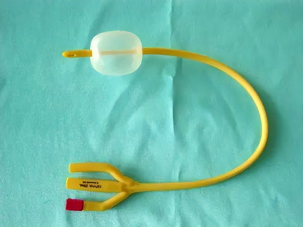 手术"插尿管"是什么体验?对以后生活有影响吗?听听患者怎么说