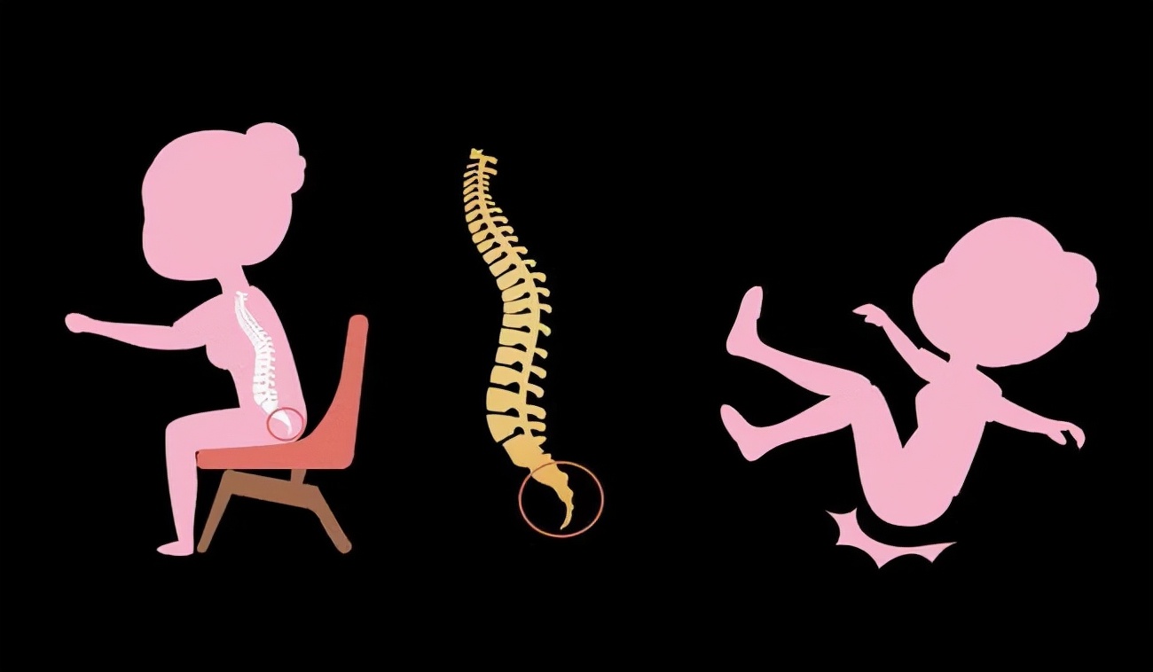 尾椎骨的准确位置图片(尾骨痛是因为坐时间长) - 赤虎壹号