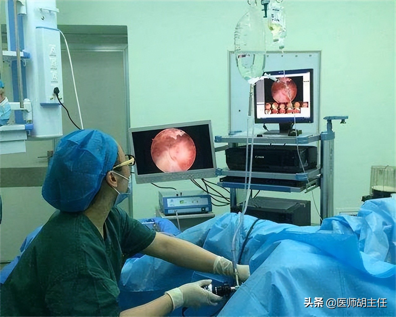 肠癌来临前，会先经历3个症状！劝告：这些高危人群不要忽略