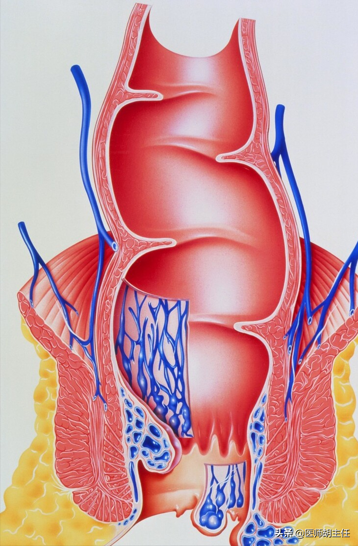 体征可能是从许多疾病中诊断出来的,例如痔疮,肛裂和带有息肉的结肠癌