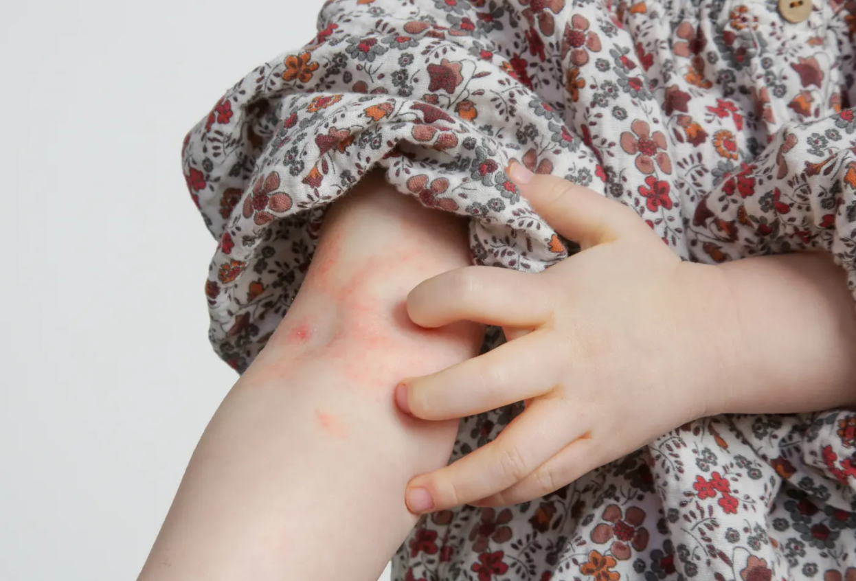 妈妈听了医生的话觉得很诧异,蚊子咬了还能有什么方法来处理吗?