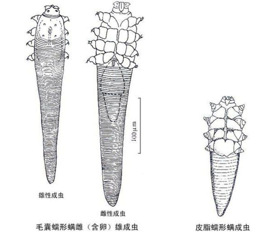 脸被太阳晒的跟碳一样黑(晒被子后有“太阳味”，是因为螨虫被烤焦了？科学家：太阳的功劳)