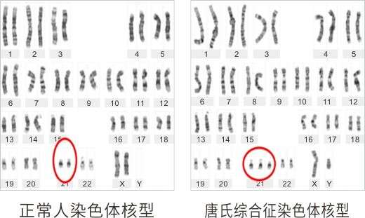 日本核事故(比凌迟更惨的死法！日本男子意外遭受核辐射，83天后全身溃烂而亡)