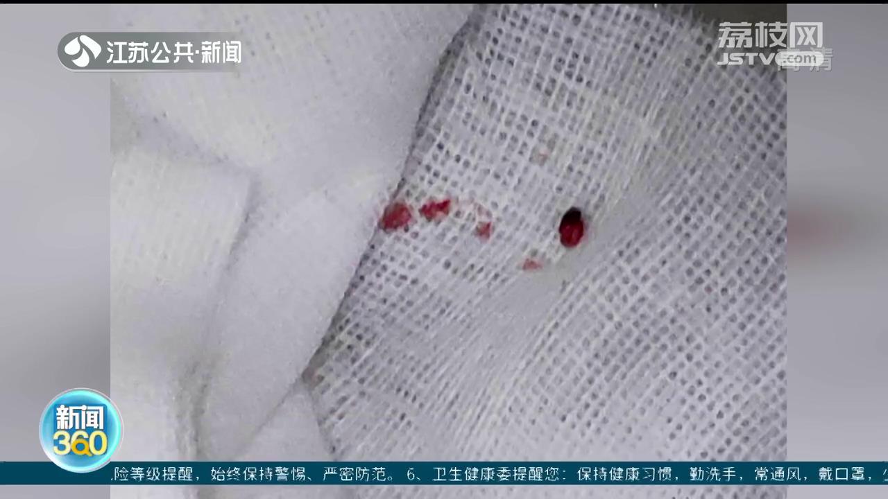 5月蜱虫出没季，当心！叮咬出现神志不清等重症表现