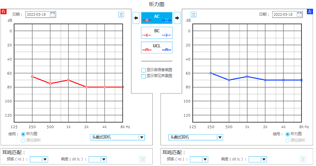 助听器总比不戴好