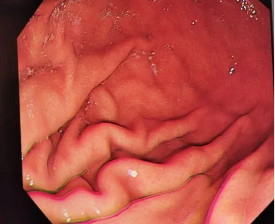 肠胃的图片真实照片图片